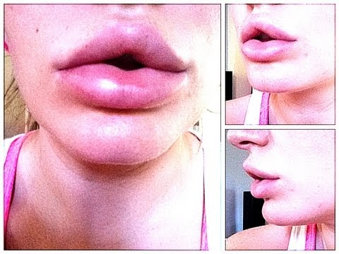 Im ersten Monat der Schwangerschaft wund Unterbauch und die untere Rücken Wie die toten Bienen von Gelenken auf Wodka bestehen