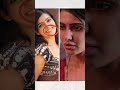 This Is All The Plastic SURGERY Samantha Ruth Prabhu Has Had Trending