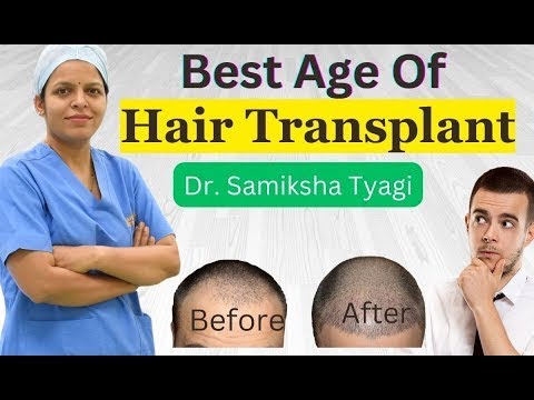 What Is The Best Age Of Hair Transplant Procedure ?