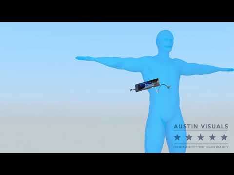 Nomad - Customer Success Story