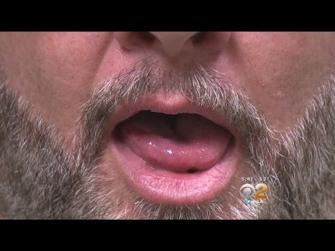 Tongue Implant Can Help Patients Solve Sleep Apnea