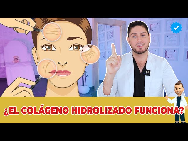 Vídeo relacionado con Colágeno Hidrolizado + Ácido Hialurónico 220 mg - 150 Cápsulas - 800 mg de Colágeno por Dosis - Piel Hidratada y Articulaciones Fuertes - Vitaminas para Cabello, Piel y Uñas - Zinc, Biotina, Selenio