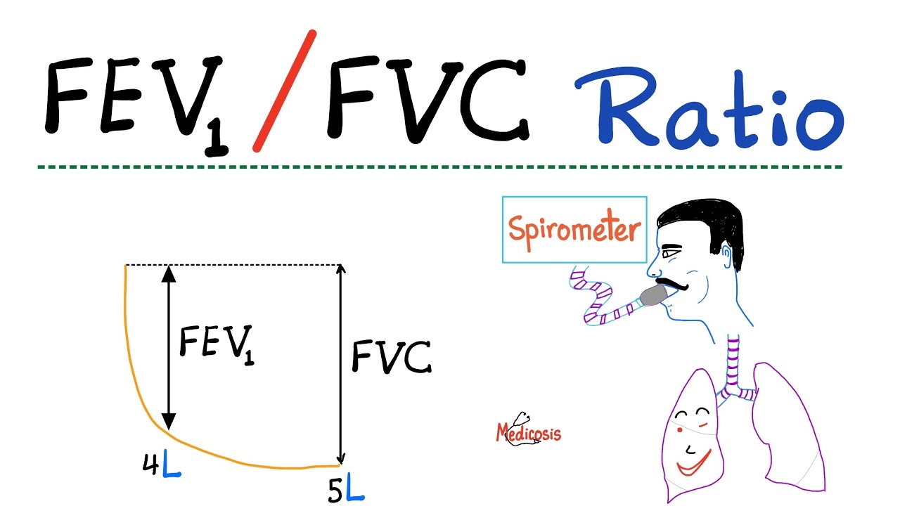 What is a normal fev1 FVC ratio? EN General