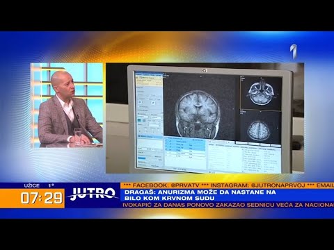 JUTRO - Šta je i zašto nastaje aneurizma, pucanje krvnog suda - gost u studiju dr. Marko Dragaš