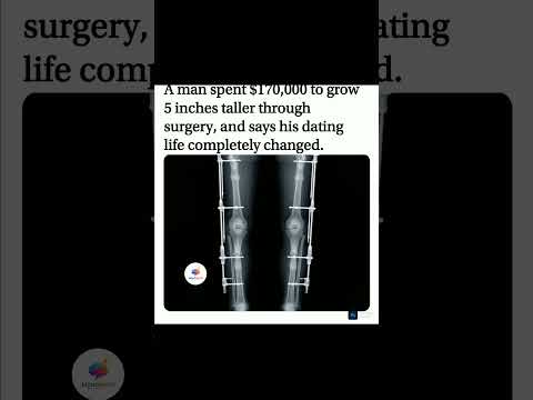 $170K for 5 inches. 💸📏 Now his dating life is on a whole new level.🔥#HeightIncrease #shorts