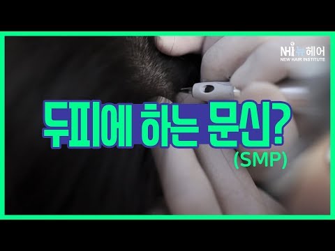 두피 문신(SMP)이란? 수술 없이 머리숱 많아 보이는 법!  - 뉴헤어 I 두피문신