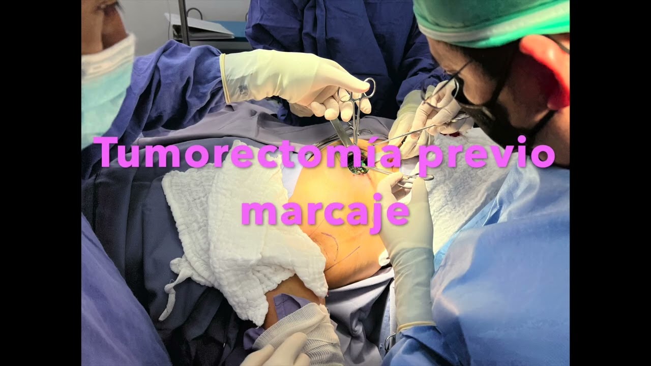 Ángel Millán Juárez-69