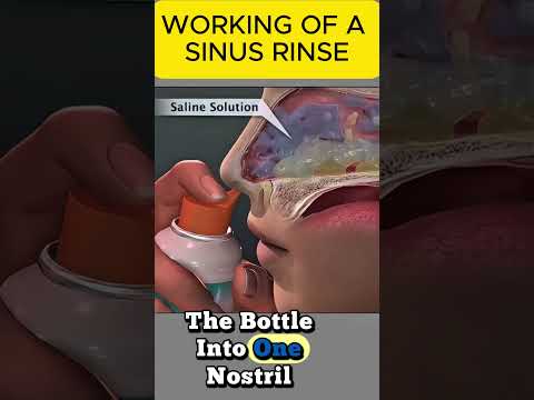 HOW SINUS RINSE WORK?
