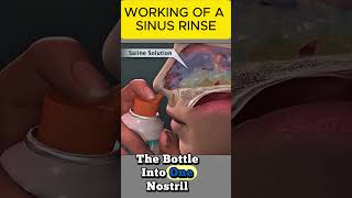 HOW SINUS RINSE WORK?