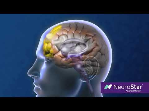 How NeuroStar TMS Therapy Works