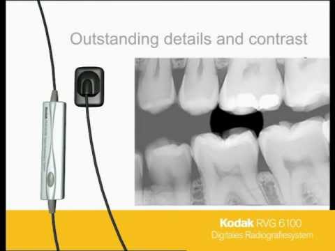 Rvg digital intra oral sensor