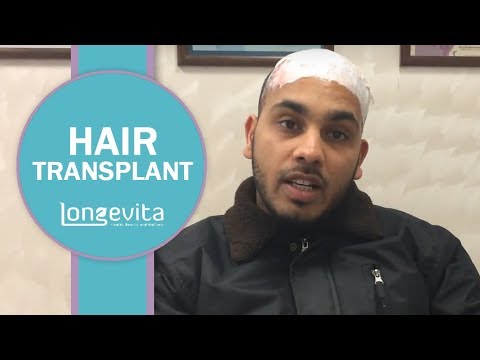 Hair Transplant Patient Journey in Turkey | Longevita