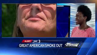 Alert Day: Great American Smokeout