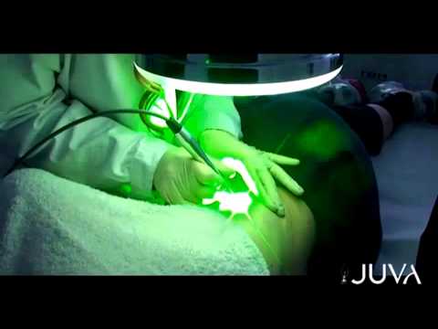 Lo splendore di siero contro pigmentary nota risposte vinoperfekt Maschera di crema di forte di spugna di acqua dolce con la decolorazione di crescione indiana