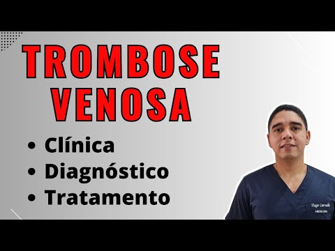 Trombose Venosa Profunda Diagnóstico e Tratamento
