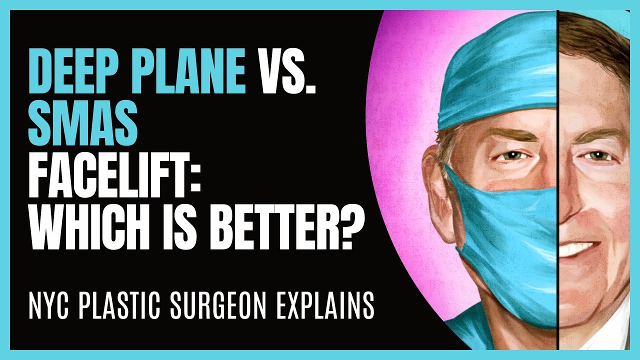 Best Facelift: Deep Plane vs. SMAS