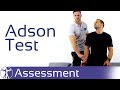 Adson Test Thoracic Outlet Syndrome TOS