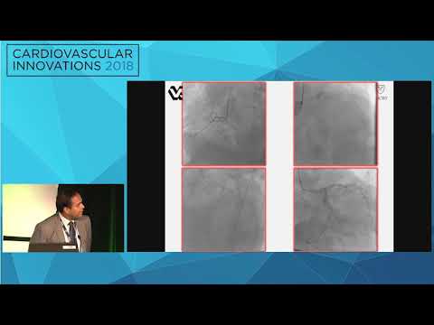 CVI2018 Session: My Best Case of the Year - Gautam Kumar, MD