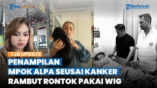 Potret Transformasi Mpok Alpa saat Melawan Kanker, Dulu Berambut Tebal hingga Rontok Pakai Wig