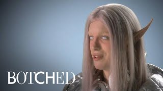&quot;Botched&quot; Patient Wants to Be the Perfect Space Elf | E!