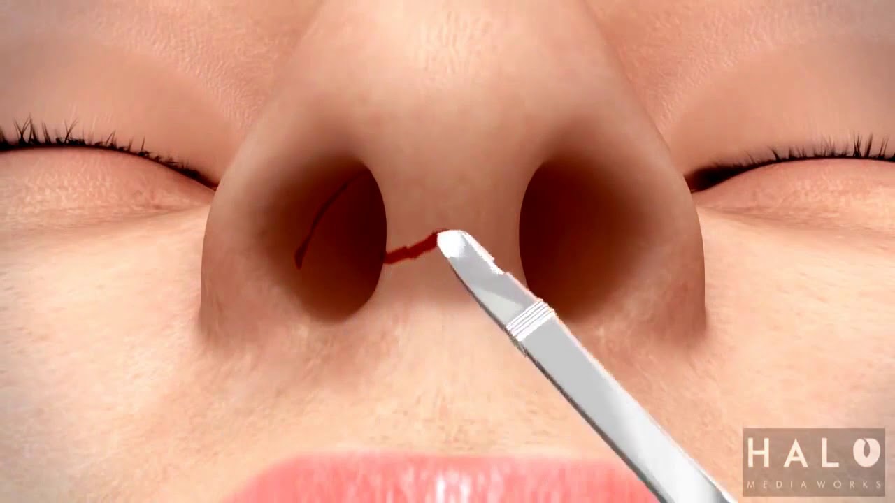 Lauro Otacilio Campos De Sousa-42