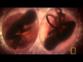 Documentary Science - In the Womb: Multiples