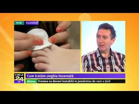 Cel mai puternic unguent analgezic pentru articulații