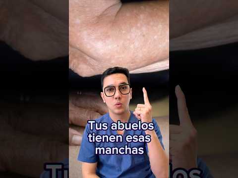 Your parents and grandparents have these skin spots (idiopathic guttate hypomelanosis). #medicine