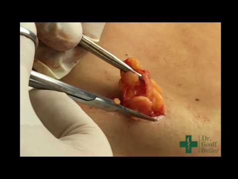 Quale miglior droga in osteoartrite del ginocchio Limmagine di una colonna vertebrale sana della colonna vertebrale cervicale
