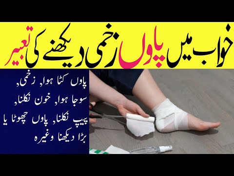 Seeing injured foot in dream | Seeing cut foot in dream | Foot dream interpretation