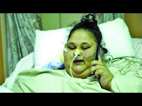 Body Transformation: Eman Ahmed now weighs 358 kg