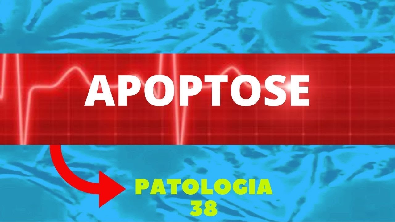 APOPTOSE - PATOLOGIA 38