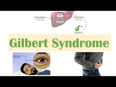 Gilbert Syndrome | Causes (Genetics), Pathogenesis, Signs & Symptoms, Diagnosis, Treatment