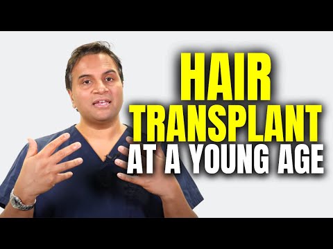 The Problem With Having A Hair Transplant At A Young Age