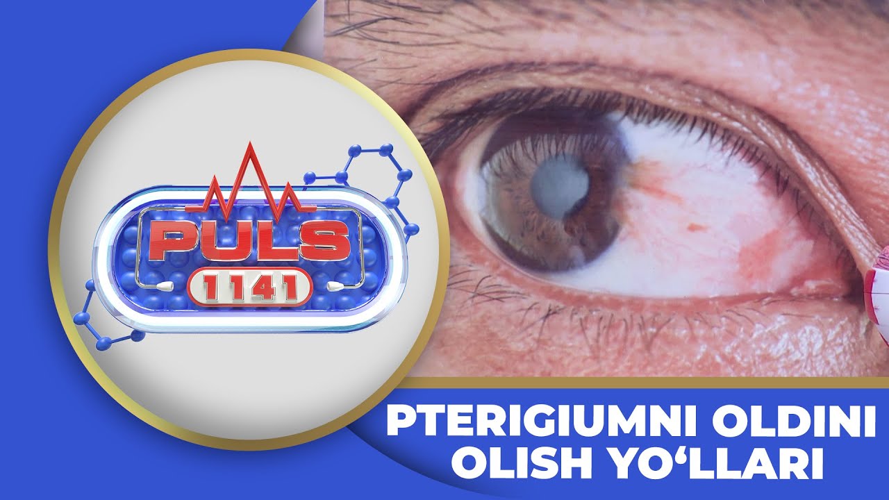 PULS 1141 - PTERIGIUMNI OLDINI OLISH YO‘LLARI