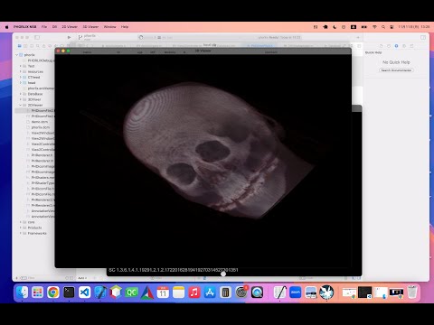 保健学科 Inside PHORLIX -DB window 周り-