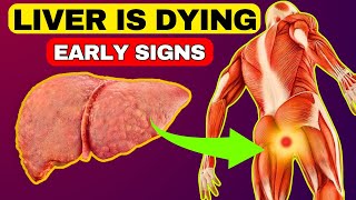 6 Weird Signs That You Have Liver Damage || HealthQuest