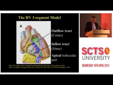Right ventricular preoperative assessment