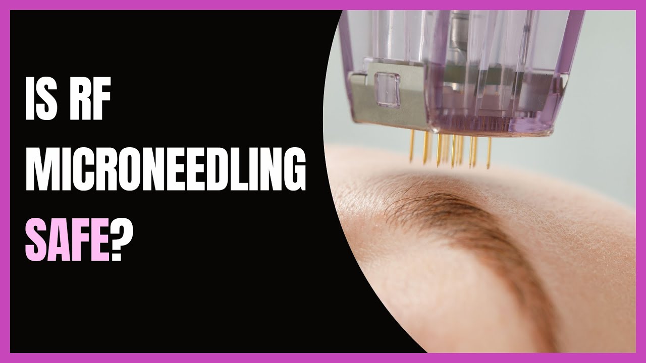 RF Microneedling Warning