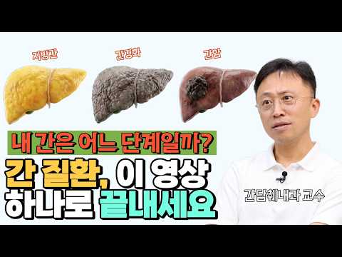 간담췌 전문의가 말하는 '침묵의 장기 간의 진실'!