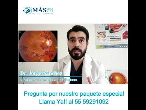 Síntomas de retinopatía diabética
