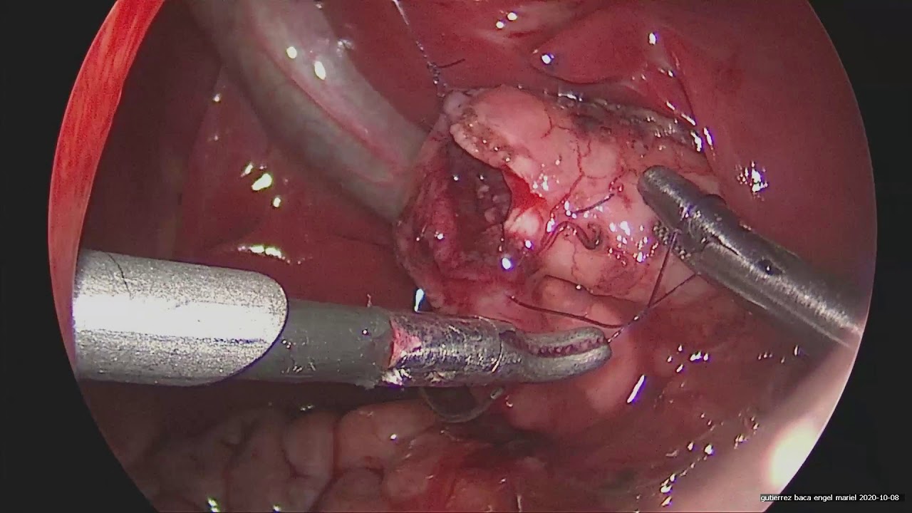 Luis Ricardo García Vázquez-3