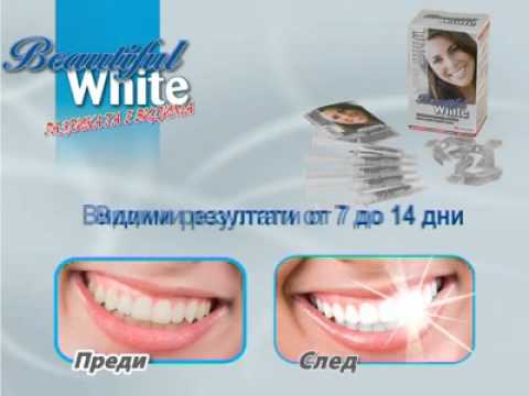 Система за избелване на зъби Beautiful White .mp4