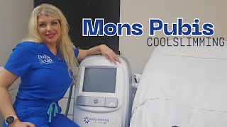 Treat your Mons Pubis with CoolSlimming