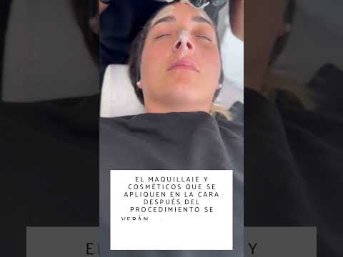 Dermaplaning