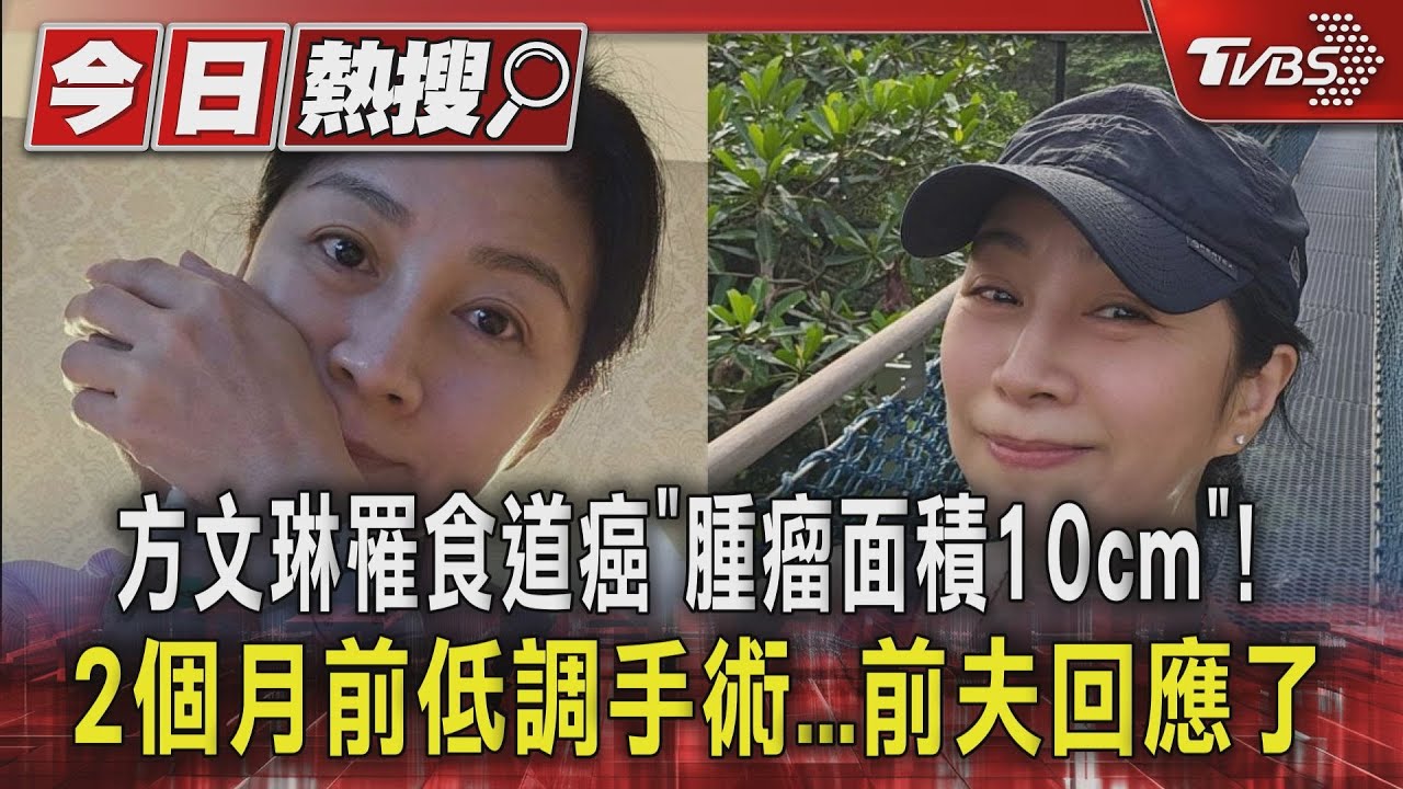 方文琳罹食道癌「腫瘤面積10cm」!2個月前低調手術 前夫回應了