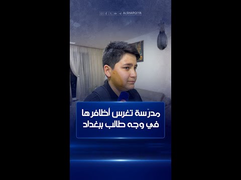 شاهد بالفيديو.. مدرّسة تغرس أظافرها في وجه طالب في إحدى مدارس الرصافة ببغداد #الشرقية_نيوز