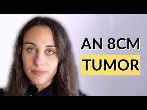 The Patient Story and Flow with Ali