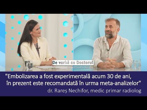EMBOLIZAREA FIBROMULUI UTERIN: VINDECARE FĂRĂ HISTERECTOMIE - Dr. Rareș Nechifor