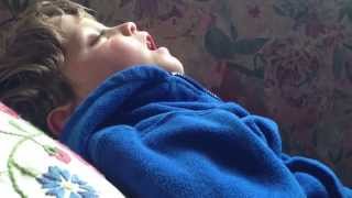 Signs of glue ear, enlarged adenoids and enlarged tonsils with snoring and sleep apnea